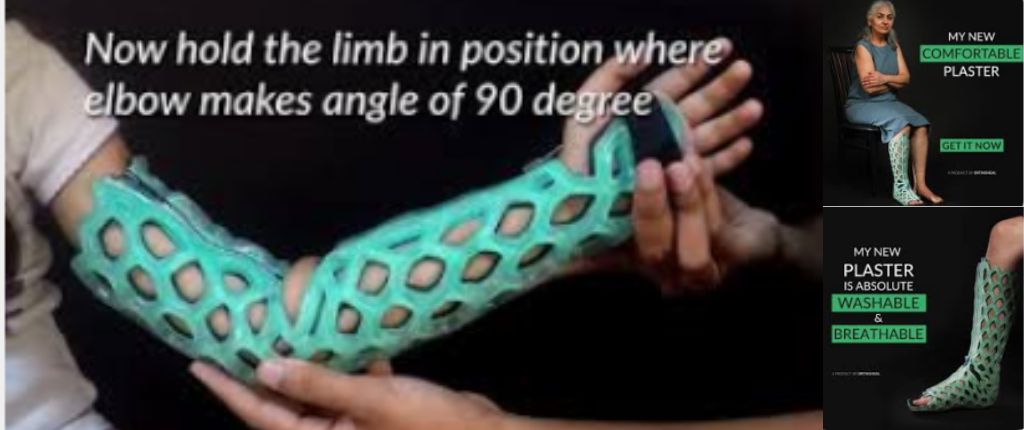 Orthoheal Flexioh Immobilizer