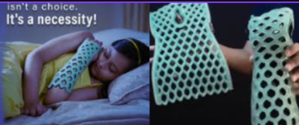 Orthoheal Flexioh Immobilizer